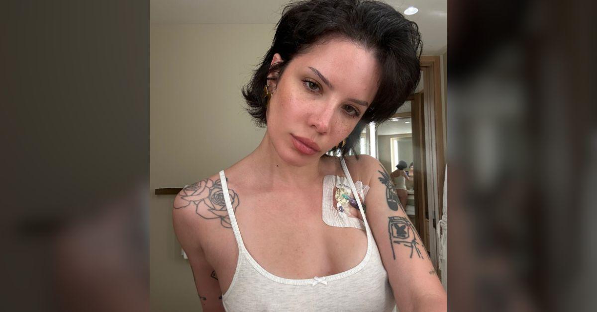 Image of Halsey has a rare autoimmune disease.