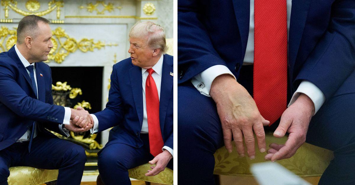 image of Donald Trump's cankles have been on display recently. 