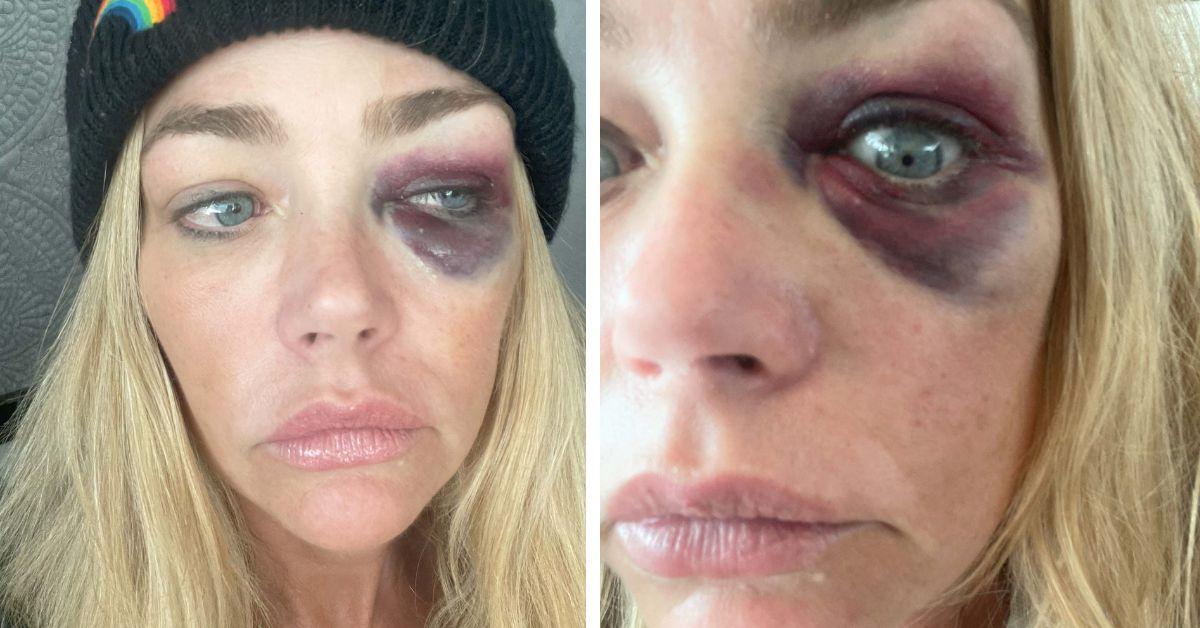 image of Denise Richards accused her ex-husband of multiple violent incidents.