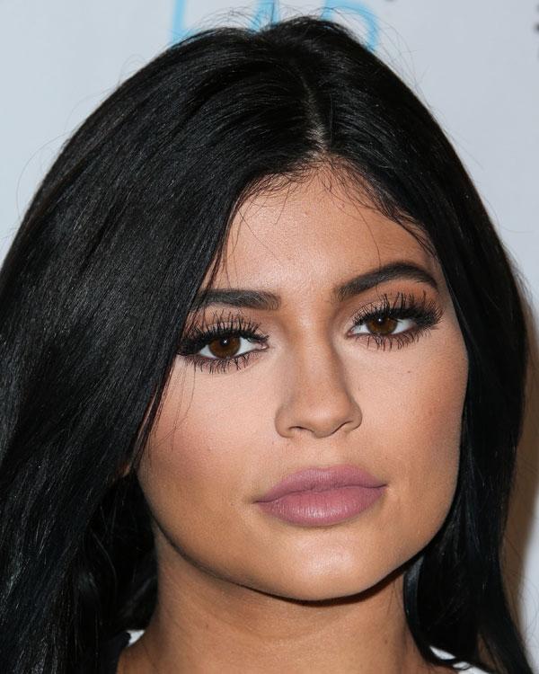 Kylie jenner lip fillers