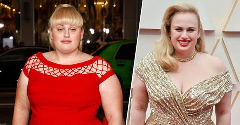 Rebel Wilson Botox Surgery Has Her Looking Younger And Refreshed