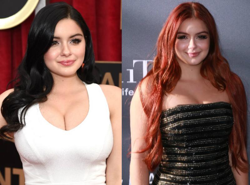 Ariel Winter Plastic Surgery — From Breast Reduction to Lip