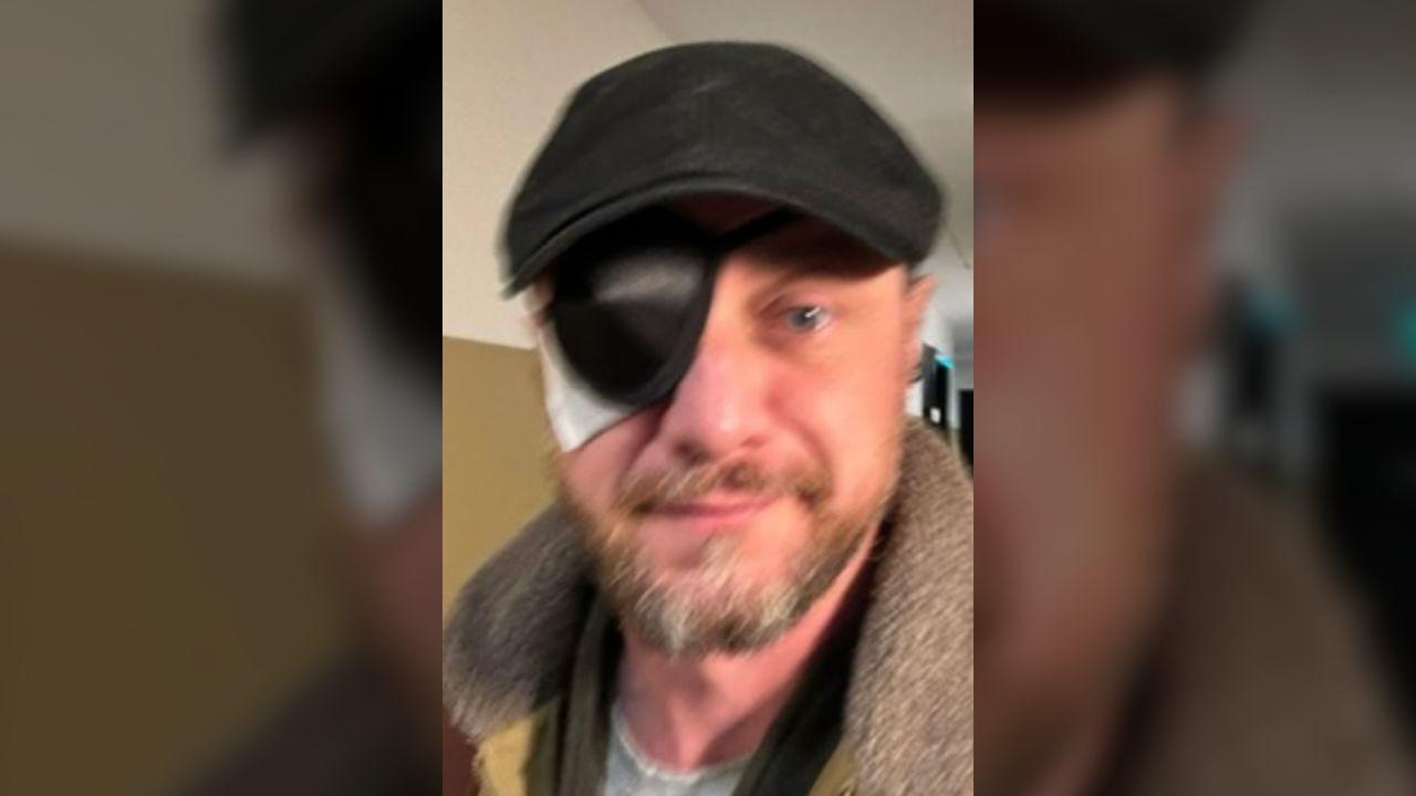 image of James initially wondered whether one of his colleagues had hit him.