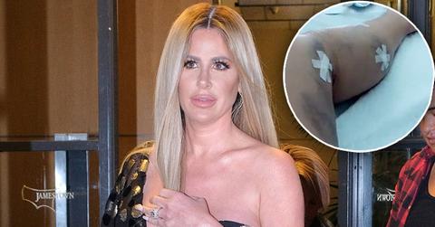 kim zolciak biermann surgery