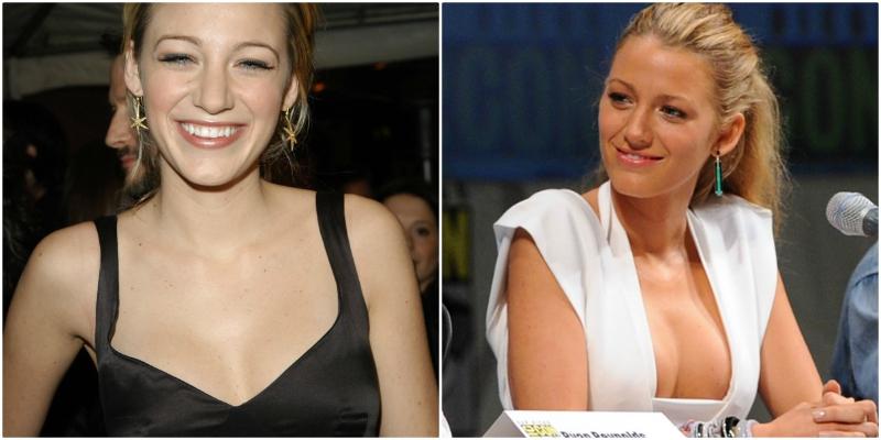 Celebrities that Have Had Breast Surgery