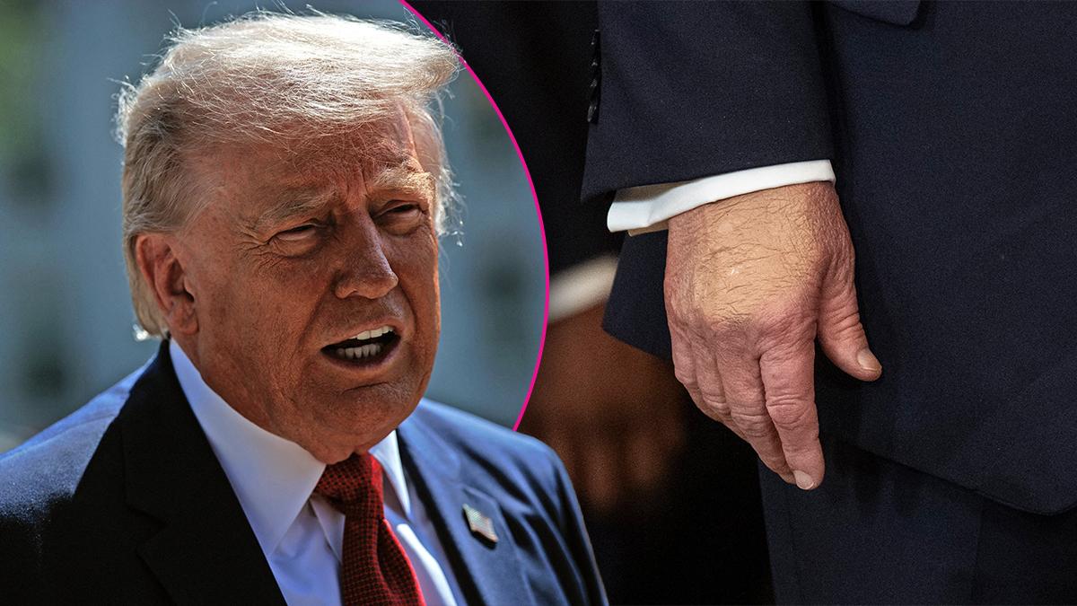 Composite photo of Donald Trump and his hand.