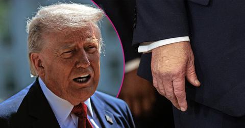 Composite photo of Donald Trump and his hand.