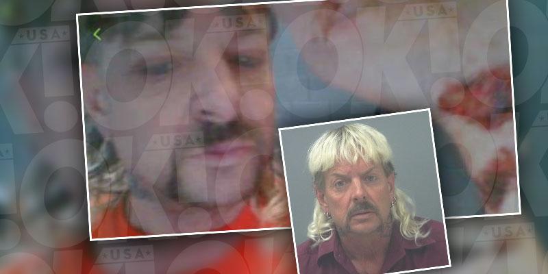 Joe Exotic Brutally Assaulted