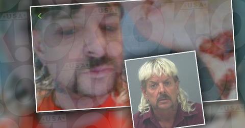 Joe Exotic Brutally Assaulted