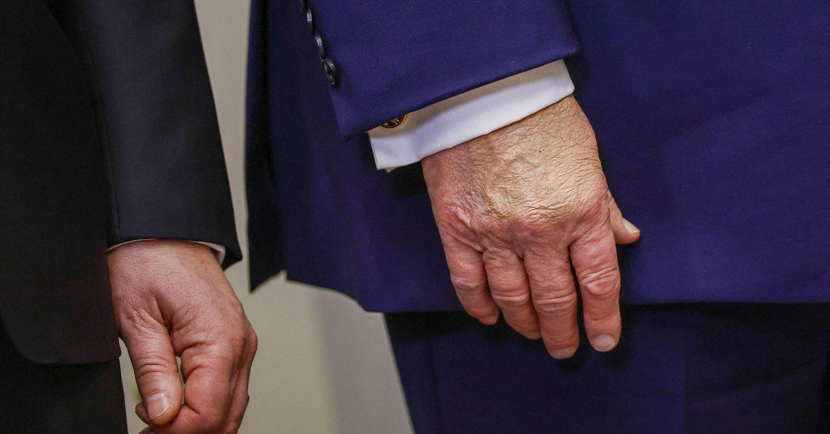 donald trump health conditions what hes said so far signs of aging