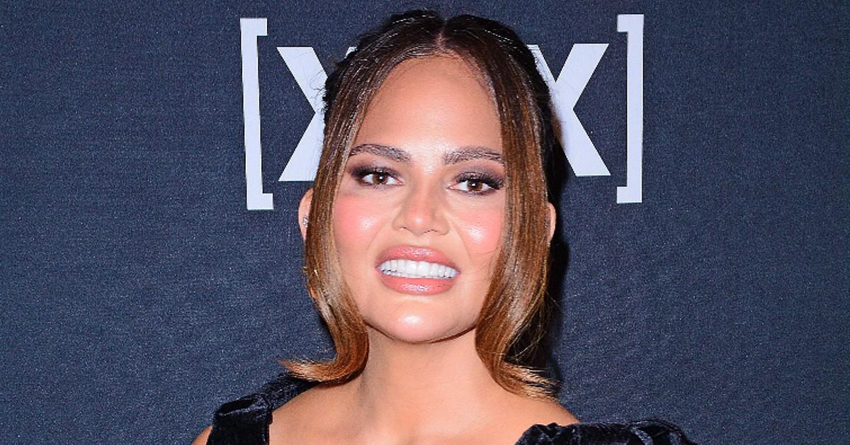 chrissy teigen anxiety hives latest red carpet event photo