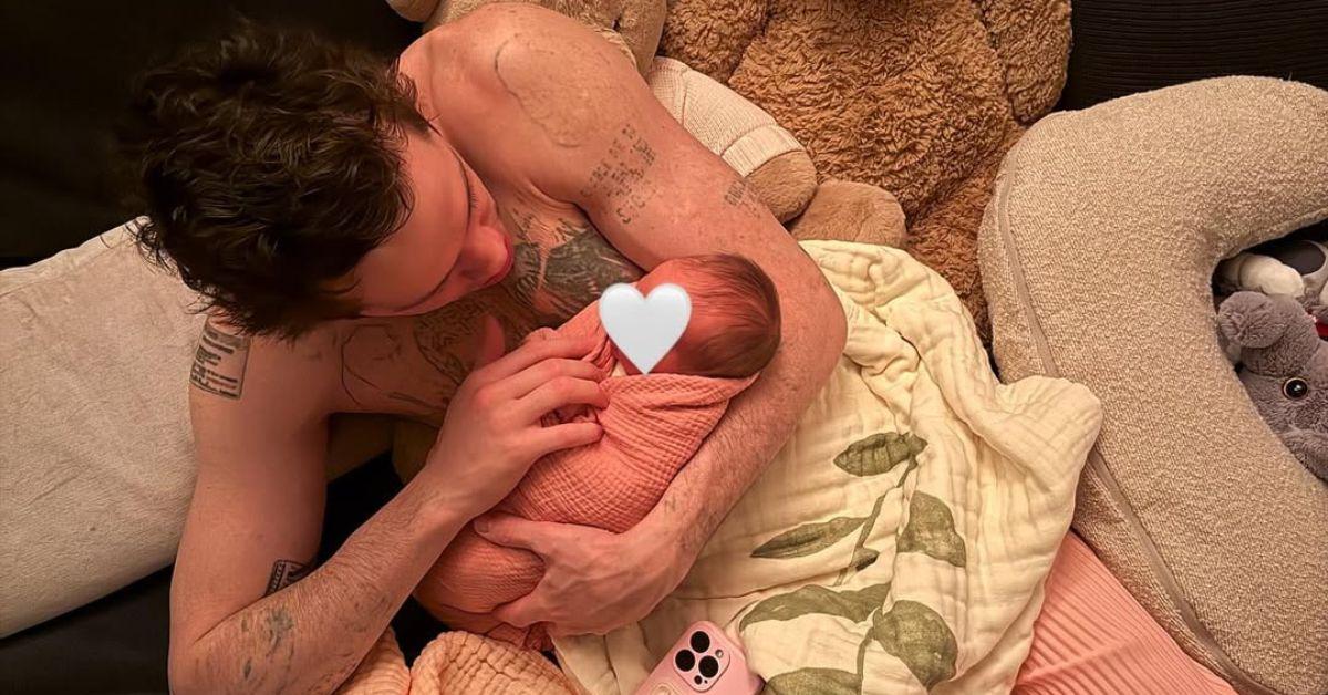 image of The photo posted on Instagram shows Pete Davidson’s tattoo removal progress.