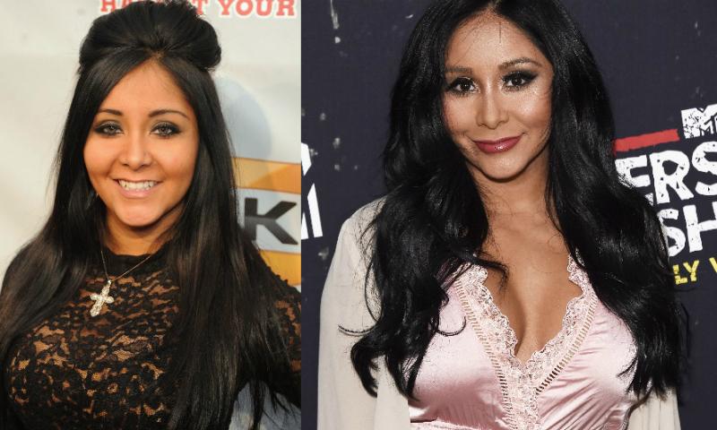 what plastic surgery did jersey shore cast get