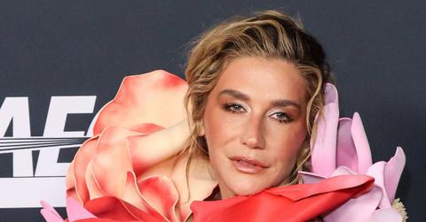 Photo of Kesha