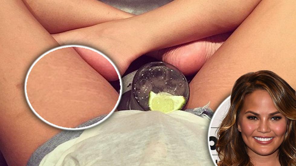 Chrissy Teigen Proves She Just Like Us By Showing Off Stretch Marks