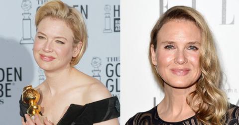 Before after renee zellweger