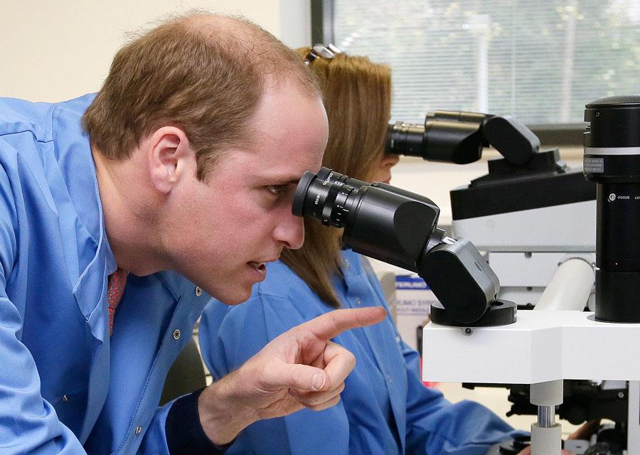 Prince harry going bald hair loss charles william 02