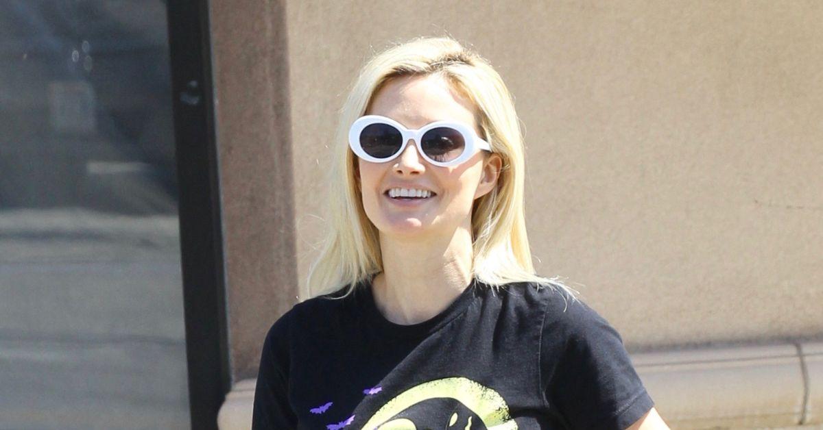 image of Holly Madison also shared that she has had Botox, CO2 laser treatments and IPL laser therapy.