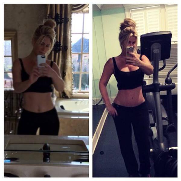 kim-zolciak-tummy-tuck