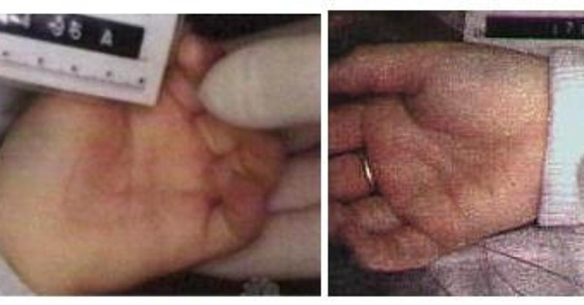 jonbenet crime scene photos hands