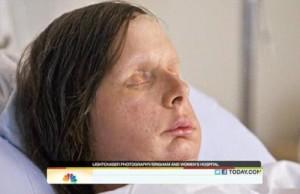 2011__08__Chimp Attack Charla Nash Aug11ne 300×194.jpg