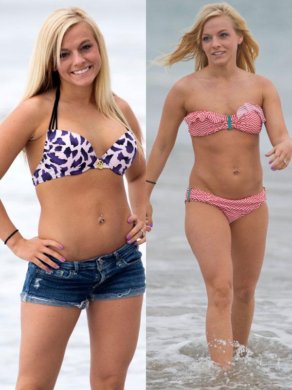 Teen mom plastic surgery