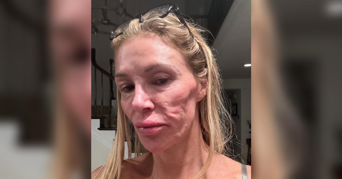 brandi glanville shakes lymphatic drainage facial parasite video