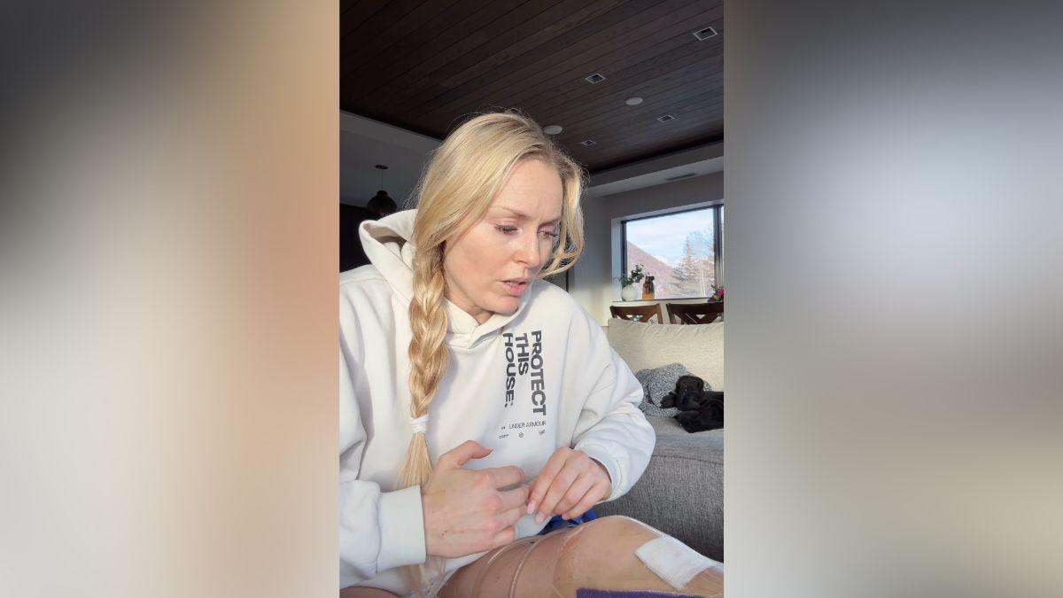 Image of Lindsey Vonn endured several surgeries.