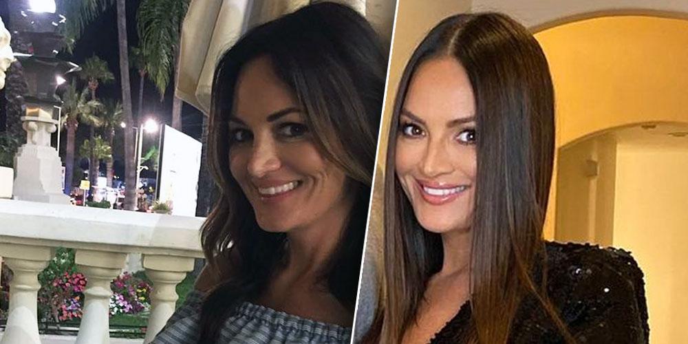 Has 'RHOSLC' Star Lisa Barton Gotten Plastic Surgery? Experts Weigh In