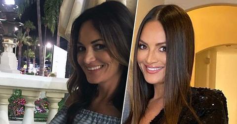 Has 'RHOSLC' Star Lisa Barton Gotten Plastic Surgery? Experts Weigh In