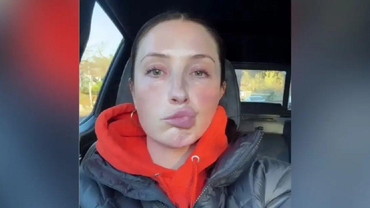 Photo of Bristol Palin first revealed her condition in January 2025. 