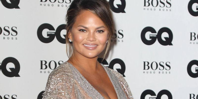 Chrissy Teigen bruise