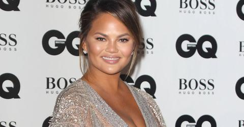 Chrissy Teigen bruise
