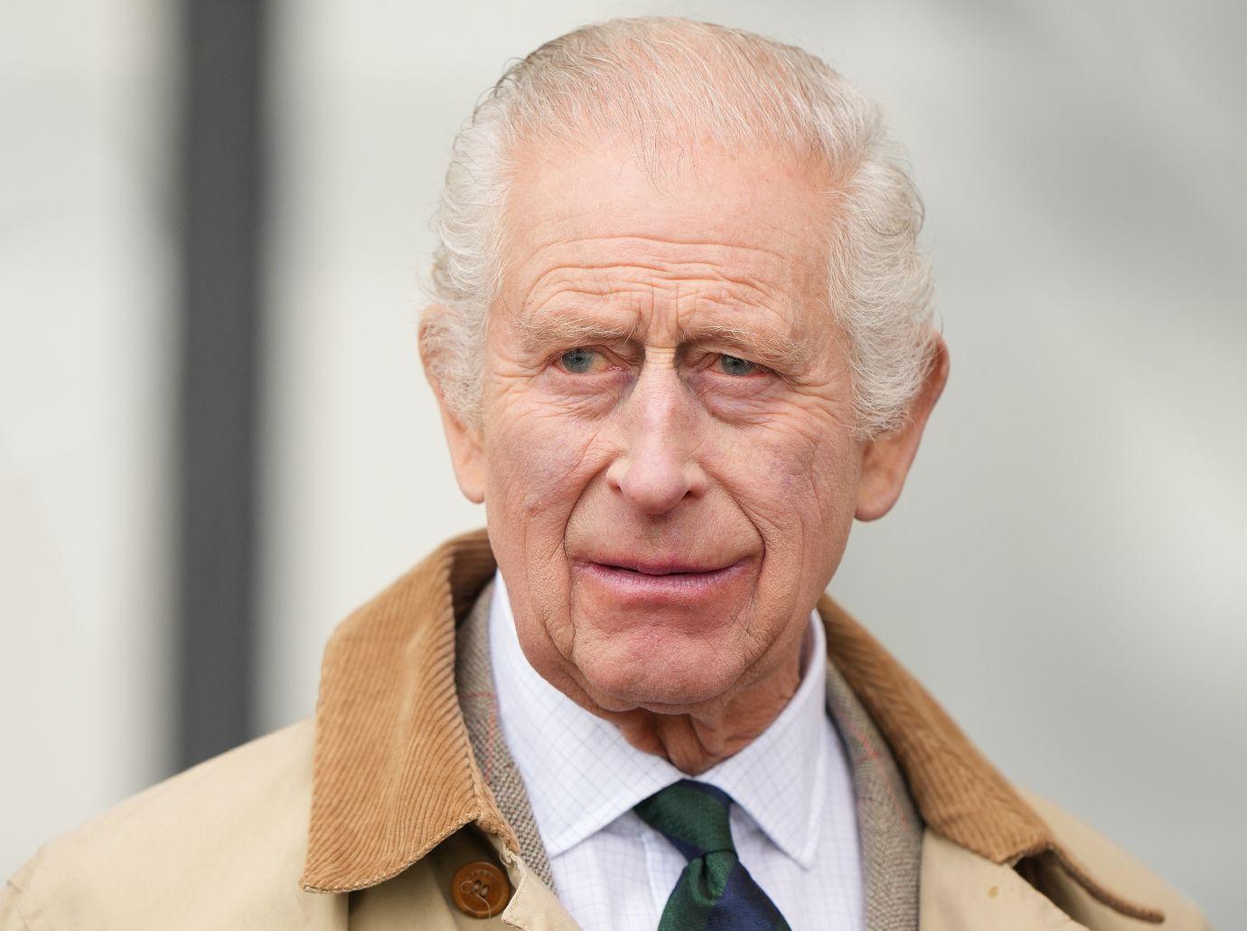 king charles reveals side effect cancer treatment