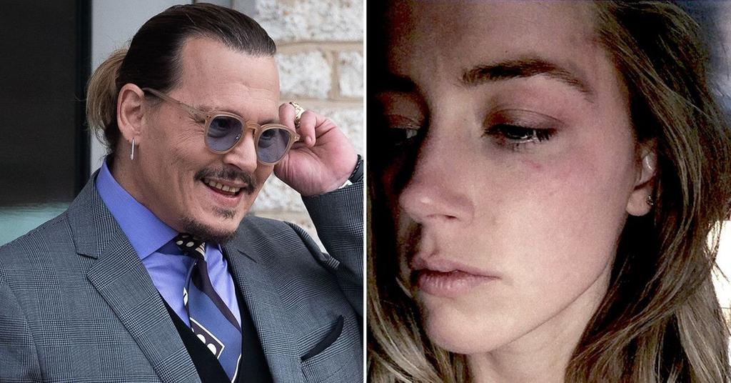 Johnny Depp Chuckles When Photo Of Amber Heards Bruised Face Shown 