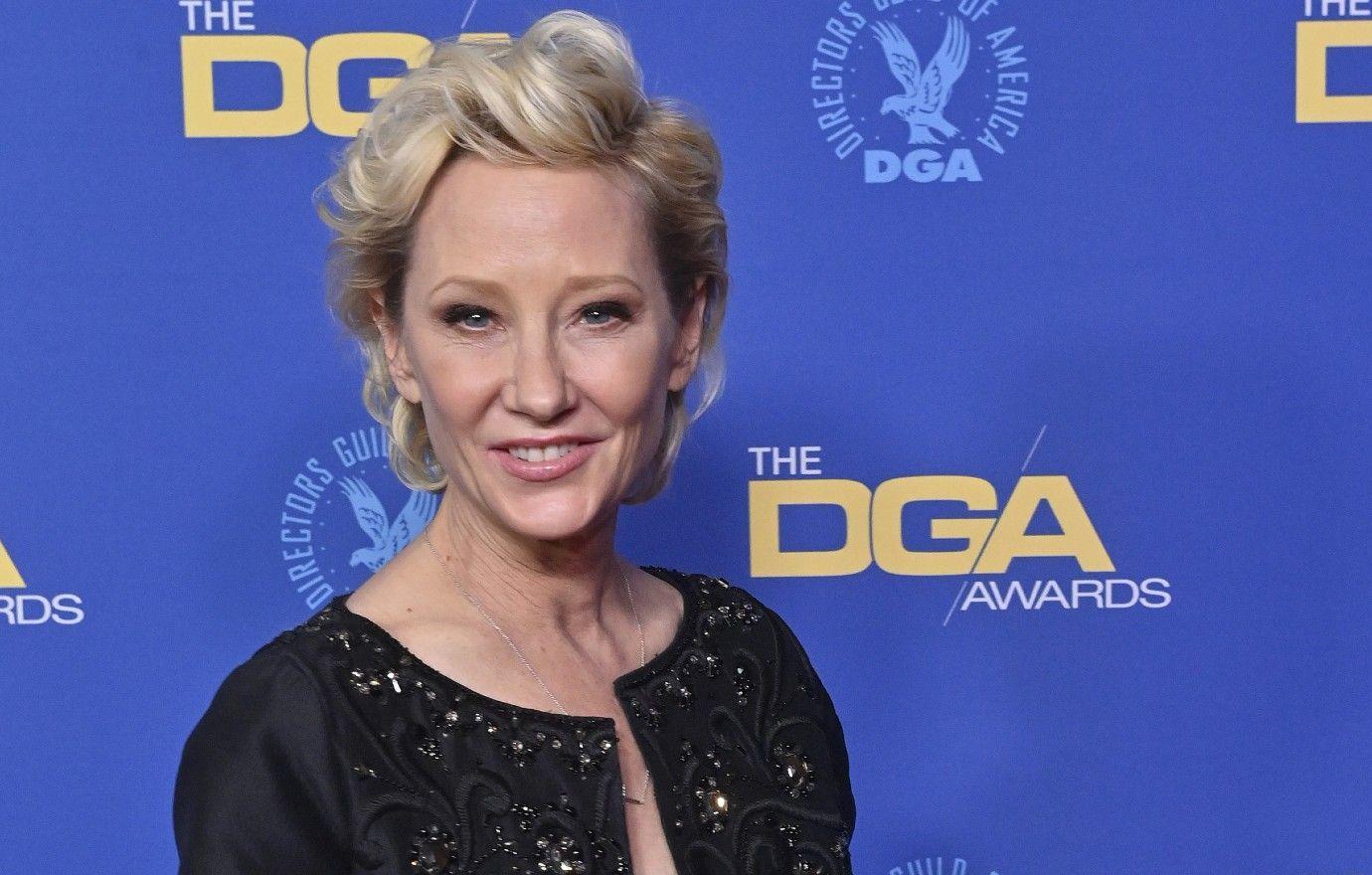 Anne Heche Expected To Be Taken Off Of Life Support image