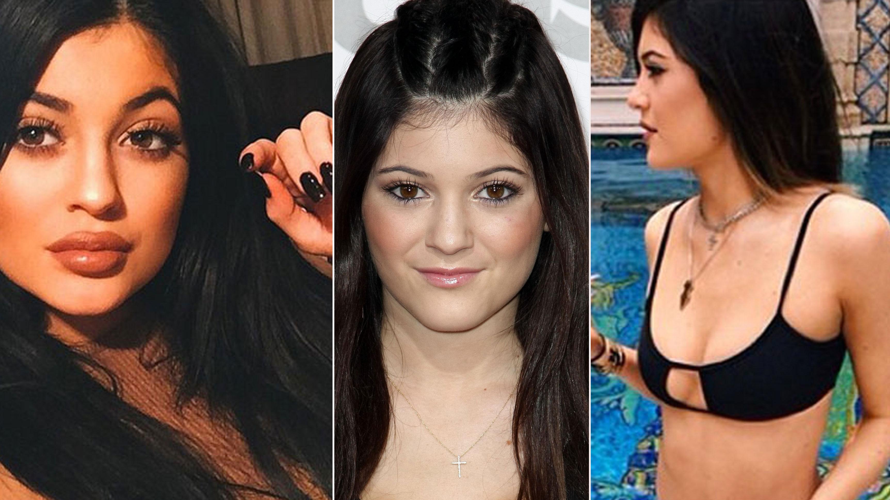 Kylie jenner before and after from 2008 to 2021 the skincare edit... 