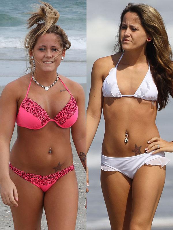 Teen mom plastic surgery