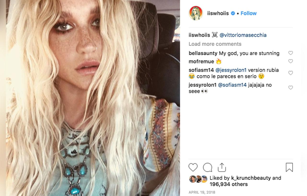 Kesha Shows Off Her Freckles In Gorgeous Makeup-Free Selfie