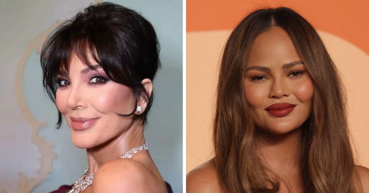 Most Shocking Celebrity Plastic Surgery Confessions Kris Jenner & More