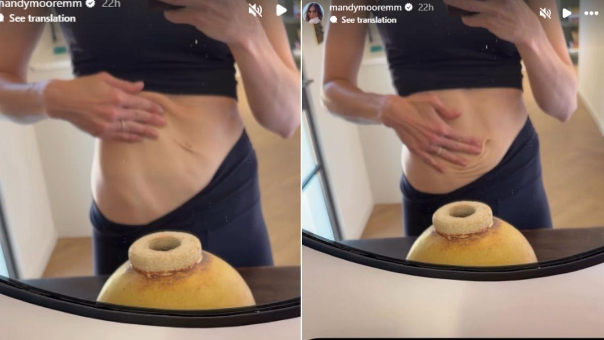 mandy moore loose skin welcoming kids