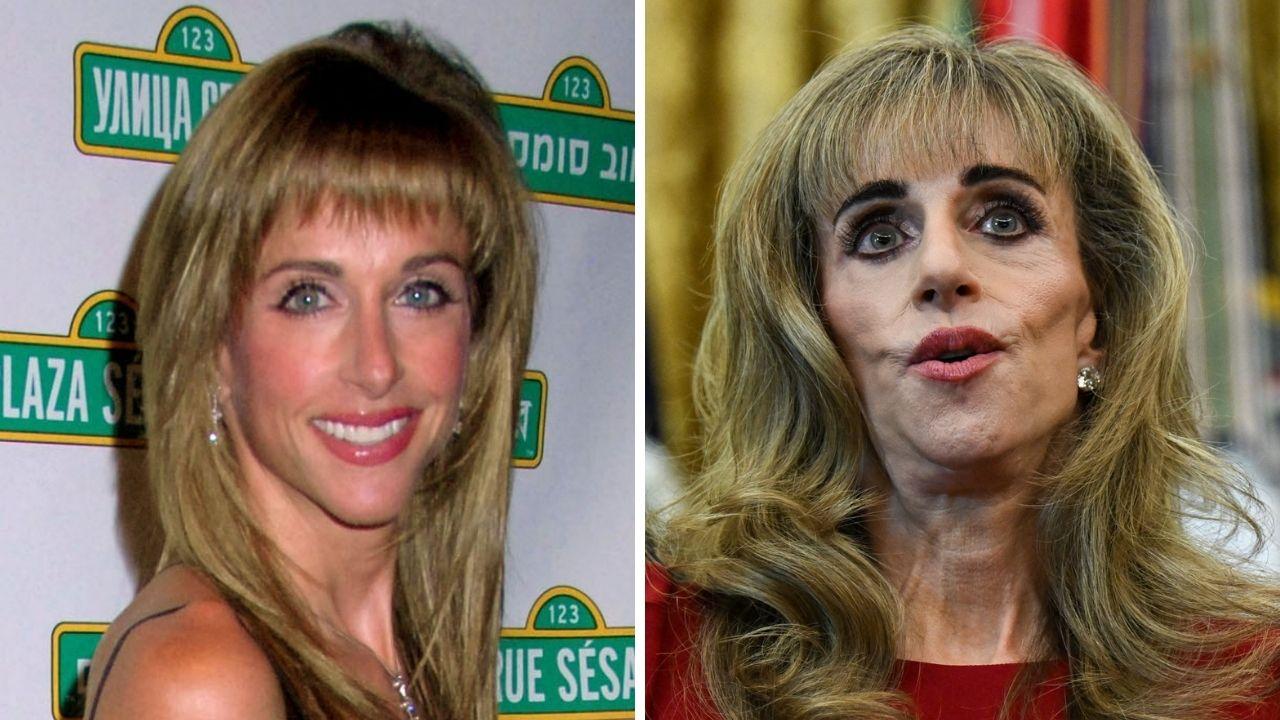 susan dell transformation before after photos