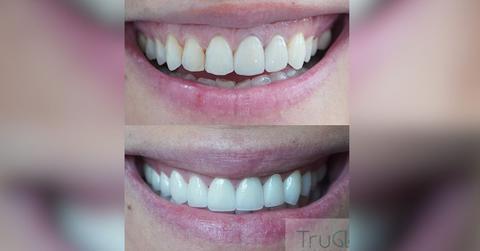 truglo modern dental membership plans offer affordable luxury service