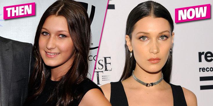 Bella Hadid Plastic Surgery Nose Job HERO