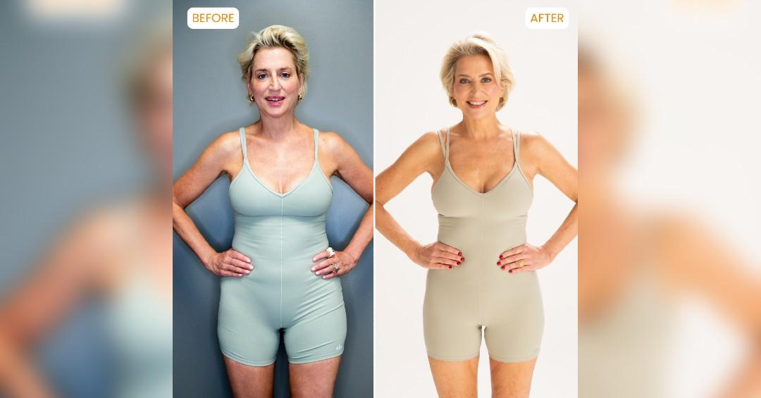 rhony star dorinda medley reveals procedure changed everything