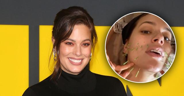 //Ashley Graham Acupuncture PP