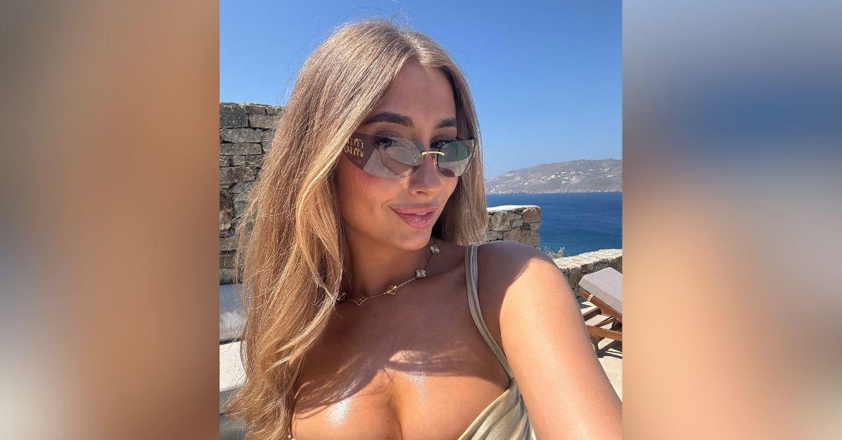 image of The adult content creator later had chin surgery with an implant and liposuction, costing about $18,900.