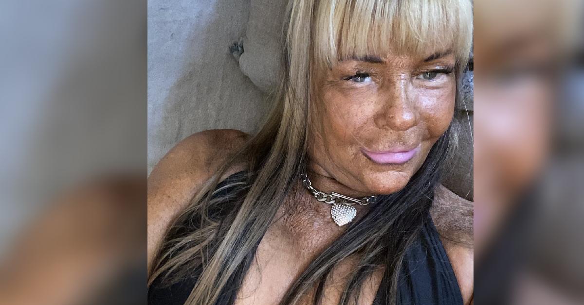 Tan Mom' Patricia Krentcil Claims She Cut Down On Tanning