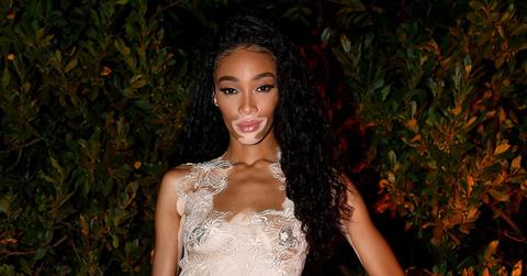 winnie-harlow-pp