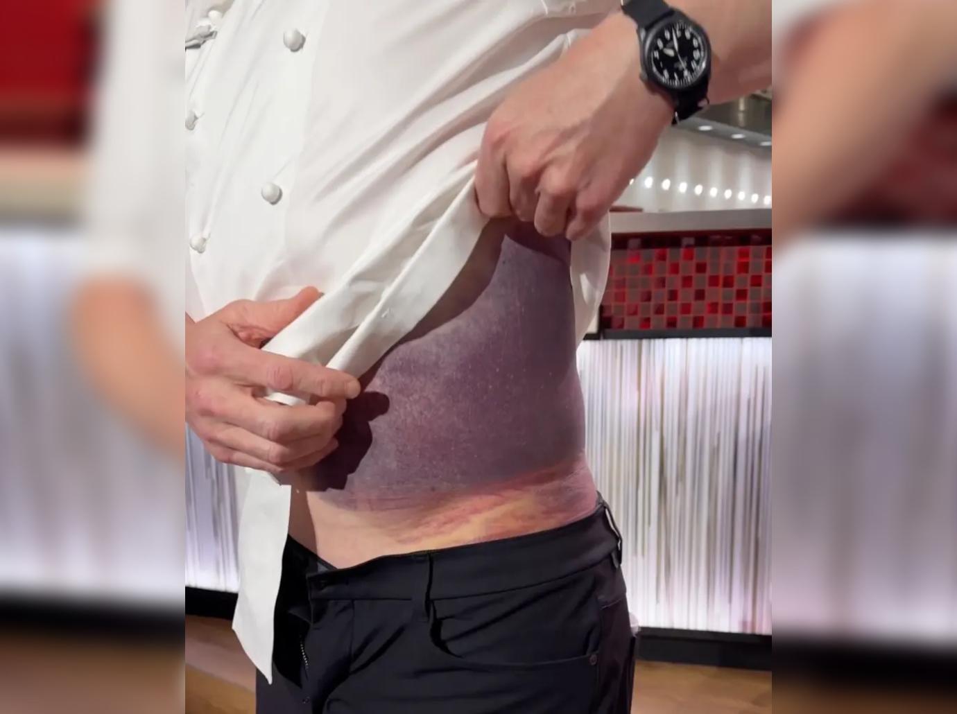 gordon ramsay bike accident underpants assistant embarrassed bruises